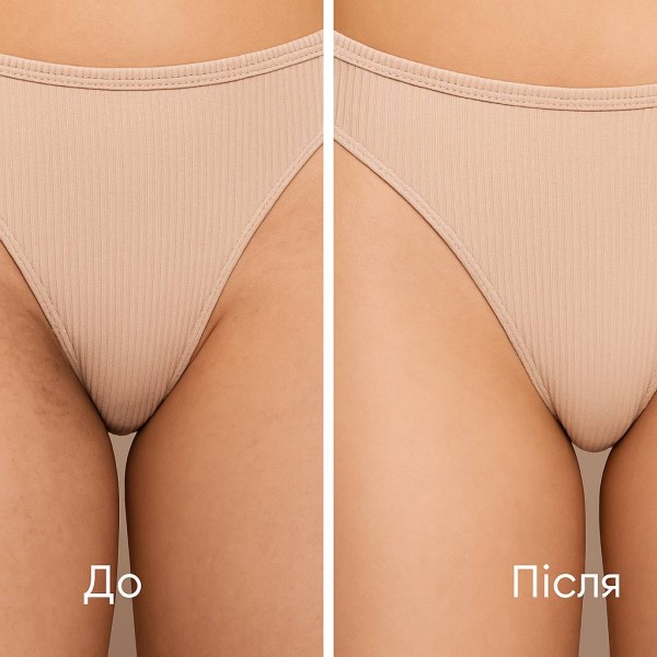 Висвітлювальна сироватка для пахв та зони бікіні HOLLYSKIN Axillait 50 мл Висвітлювальна сироватка для пахв та зони бікіні HOLLYSKIN Axillait 50 мл