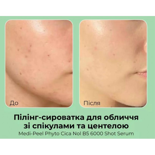 Сироватка-пілінг для проблемної шкіри Medi-Peel Phyto Cica-nol B5 6,000 Shot Serum 50 г Сироватка-пілінг для проблемної шкіри Medi-Peel Phyto Cica-nol B5 6,000 Shot Serum 50 г