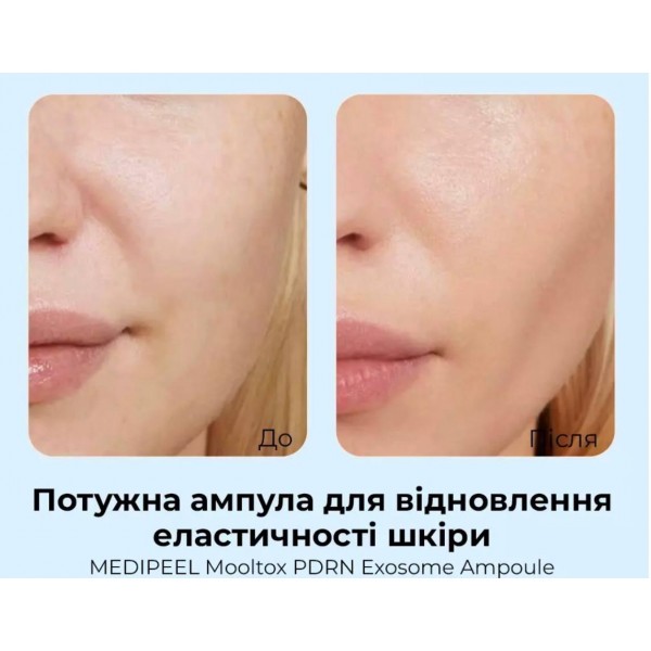 Сироватка для обличчя з полінуклеотидами та фітоекзосомами Medi-Peel Mooltox PDRN Exosome Ampoule 50 мл